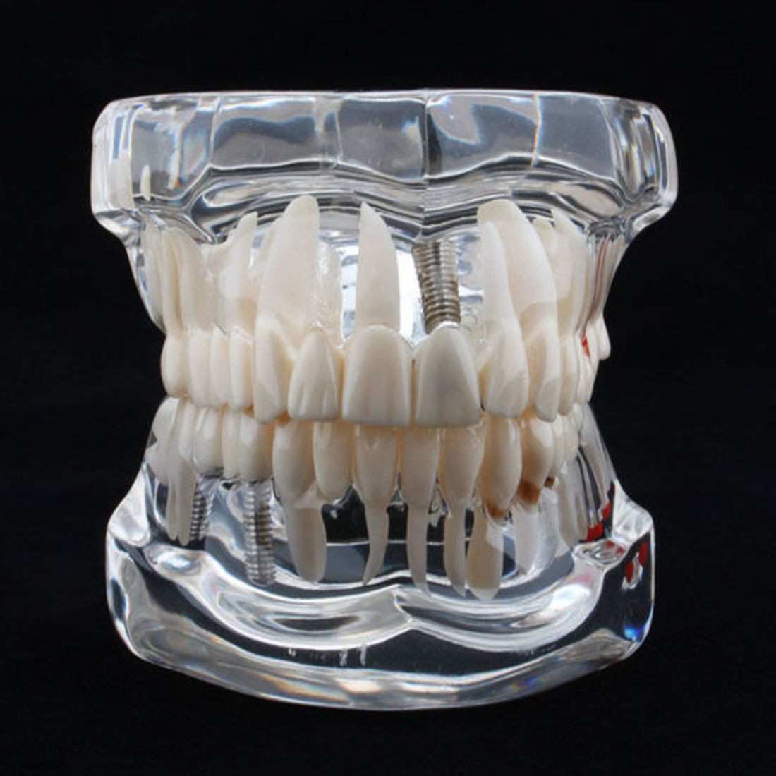 Education tooth model