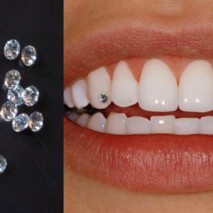 Teeth Jewel